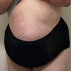 Stretch marks are my version of a â€œhappy trail.â€ So follow the trail.