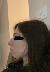 Genuinelyasking andlookingforhonestanswers butismysideprofilereallythatbad Inevergetapproached andmynoseismybiggestinsecurity Thinkingofgettingitfixedoneday 