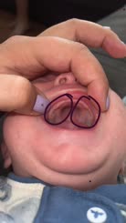 Teething   