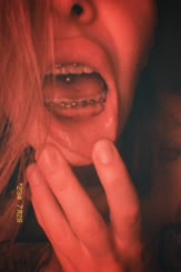  Grunge Smile: Embrace the Blemishes and Love Yours
