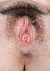 Vaginoplasty