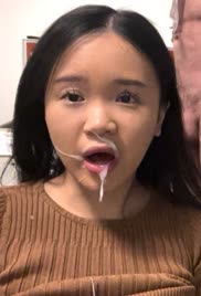 Post facial face