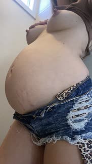 I hope the stretch marks arenâ€™t an issue ðŸ™ðŸ˜Ÿ